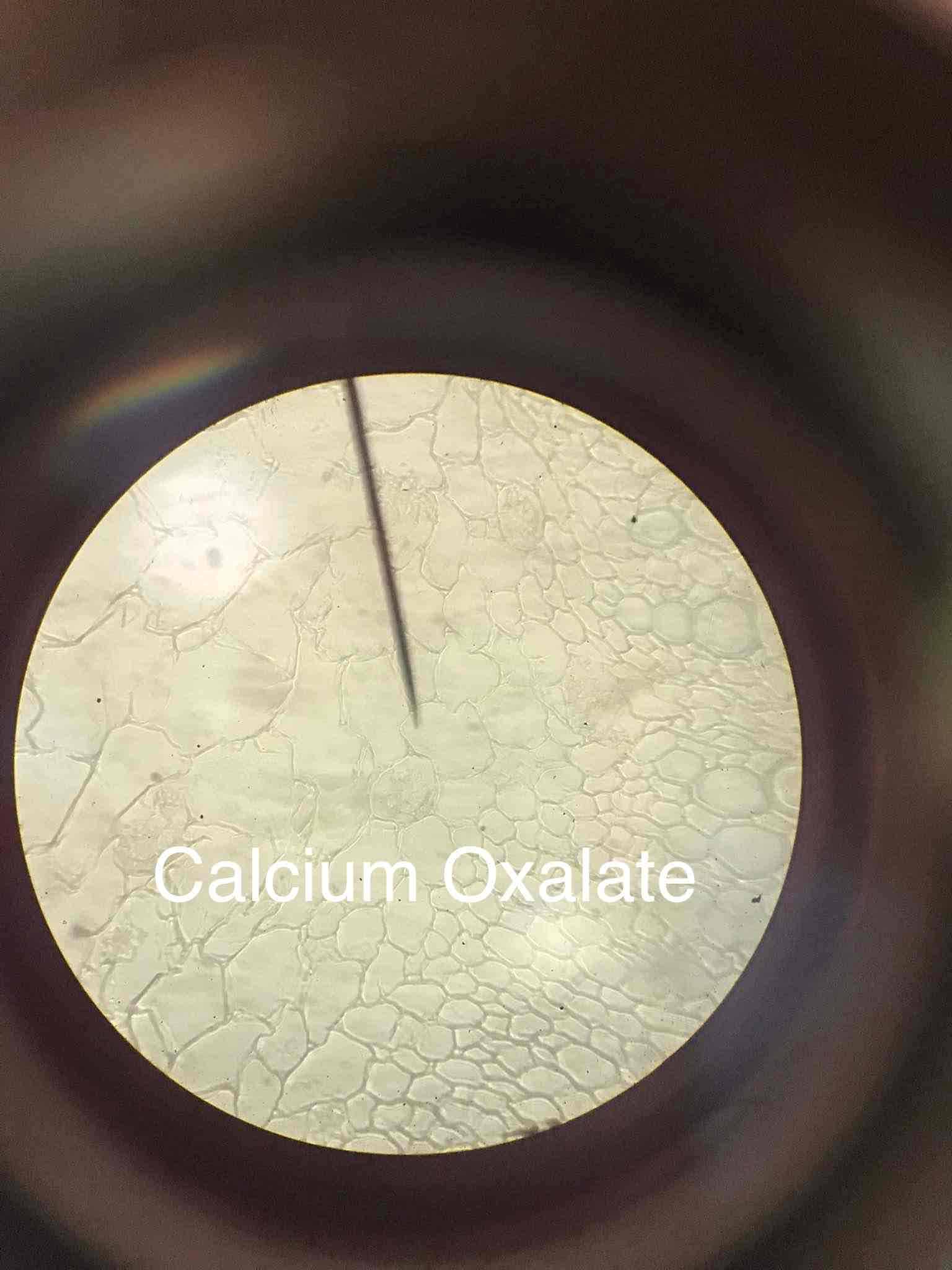 <p>Calcium oxalate crystals found in various plant tissues.</p>