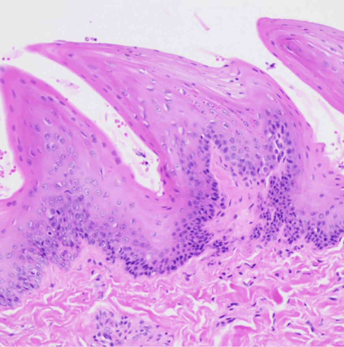 <p>What structure is this epithelium found in?</p>