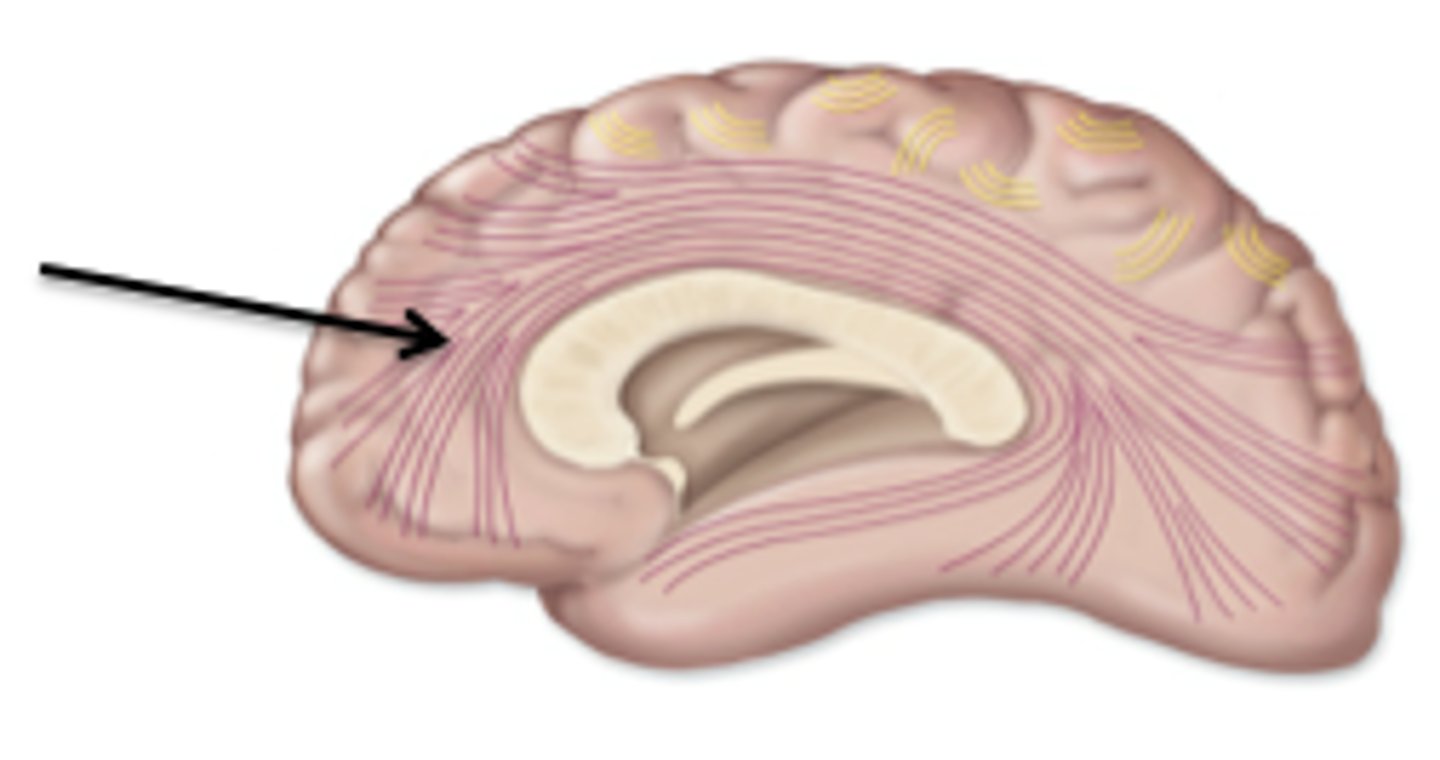 <p>conducts nerve impulses between cerebral gryri in the same hemisphere</p>