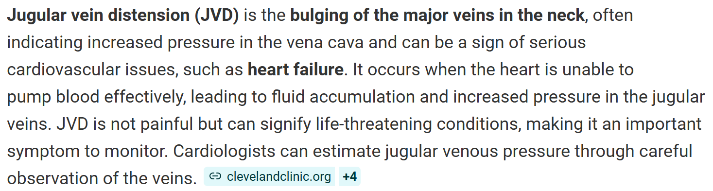 <p>Jugular Vein Distention </p>