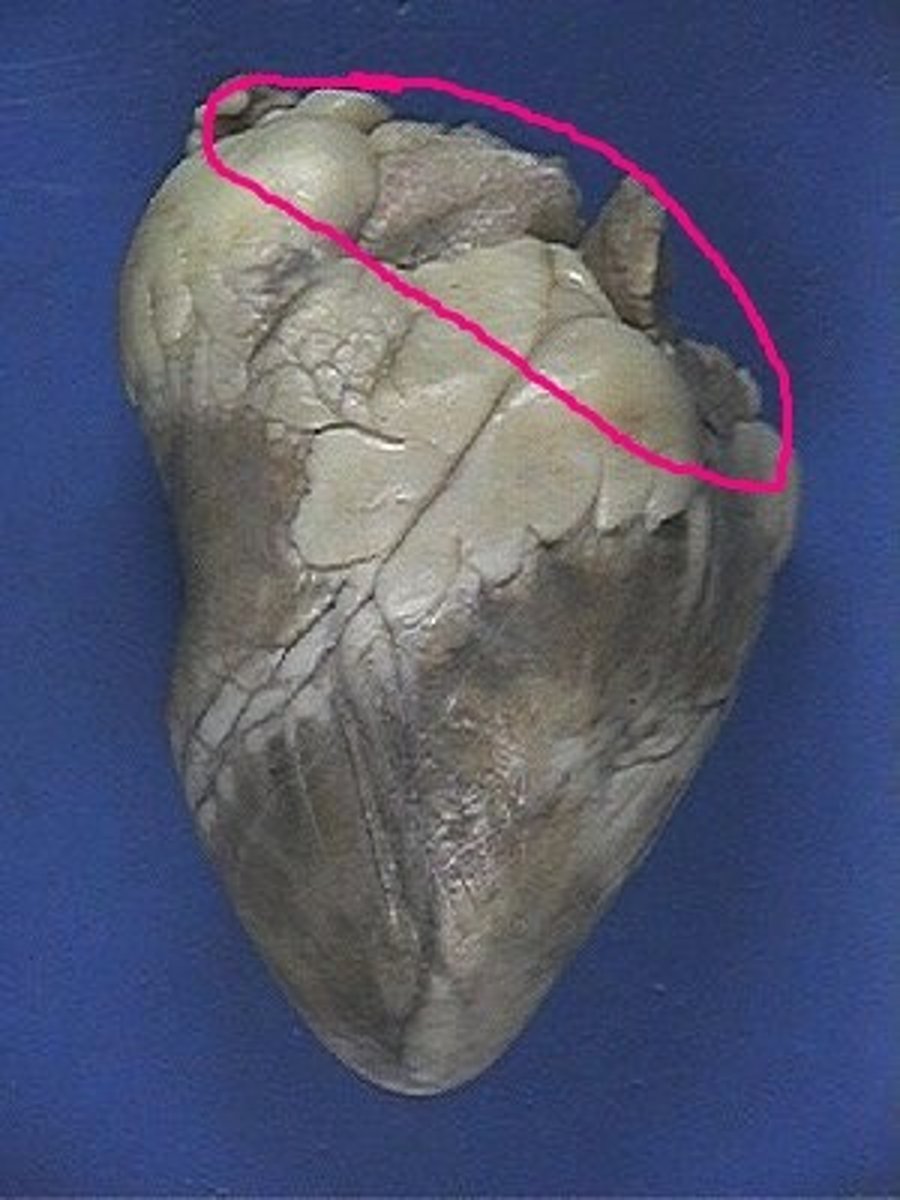 <p>Identify the top portion.</p>