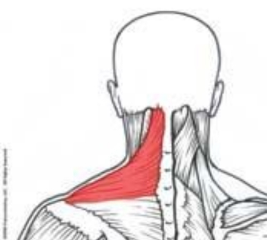 <p>what part of the trapezius is this?</p>