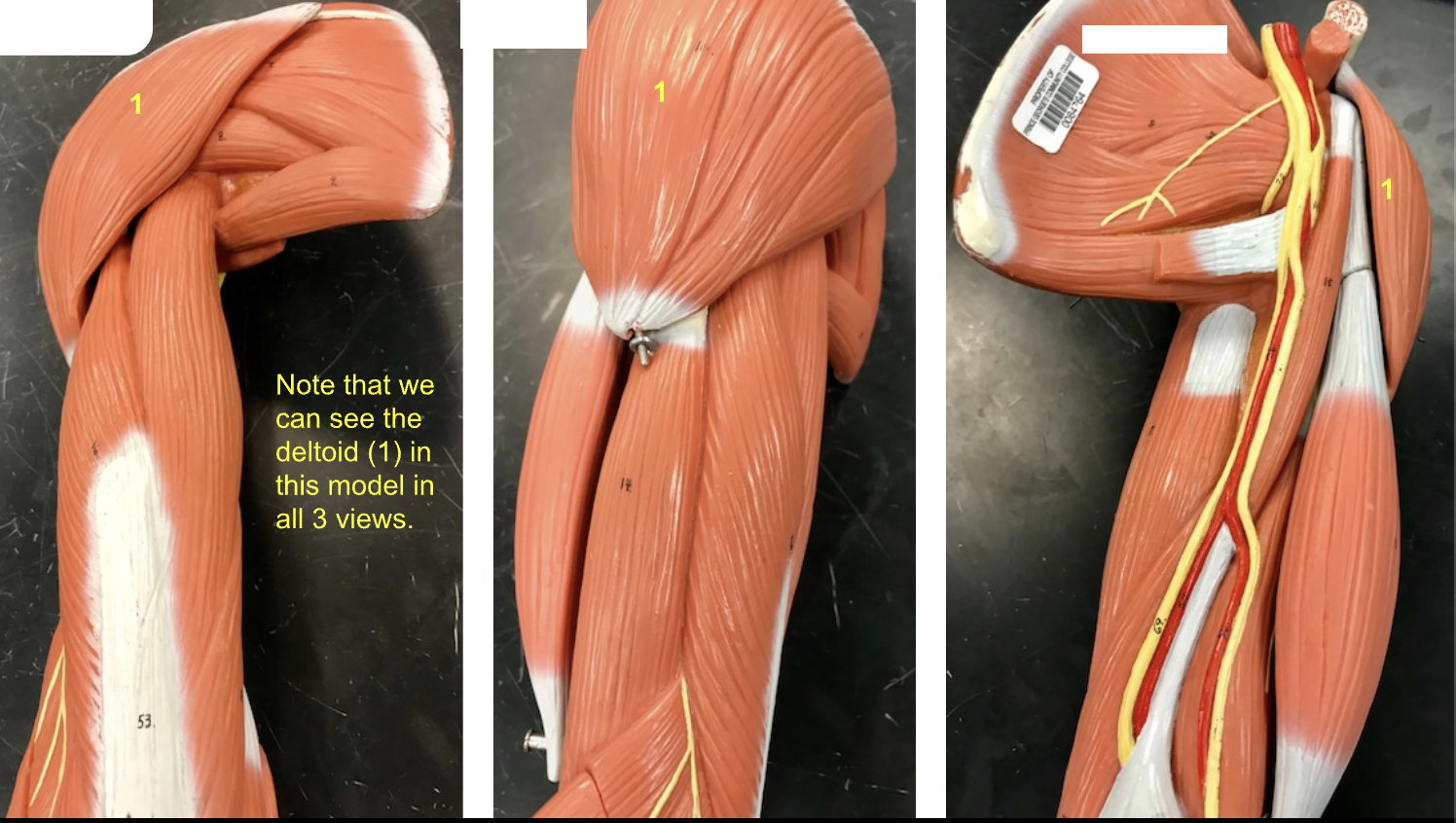 <p>Name these views of the deltoid muscle. </p>
