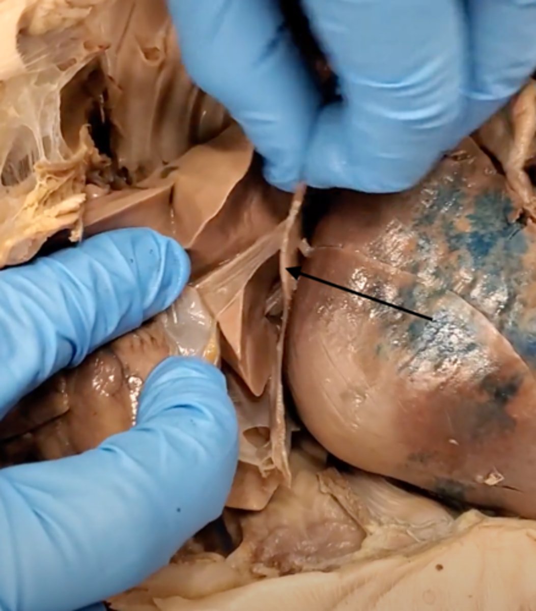 <p>Large, flat muscle at the bottom of the chest cavity that helps with breathing</p>