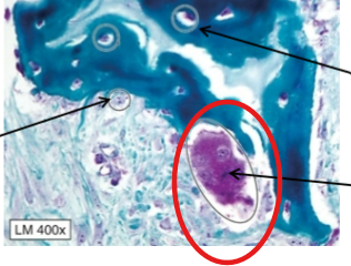 <p>Derived from hematopoietic stem cells and resorb (eat) bone matrix</p>