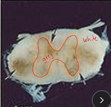 <p><span style="background-color: transparent;"><strong><span>Equine Protozoal Myeloencephalitis (EPM)</span></strong></span></p>