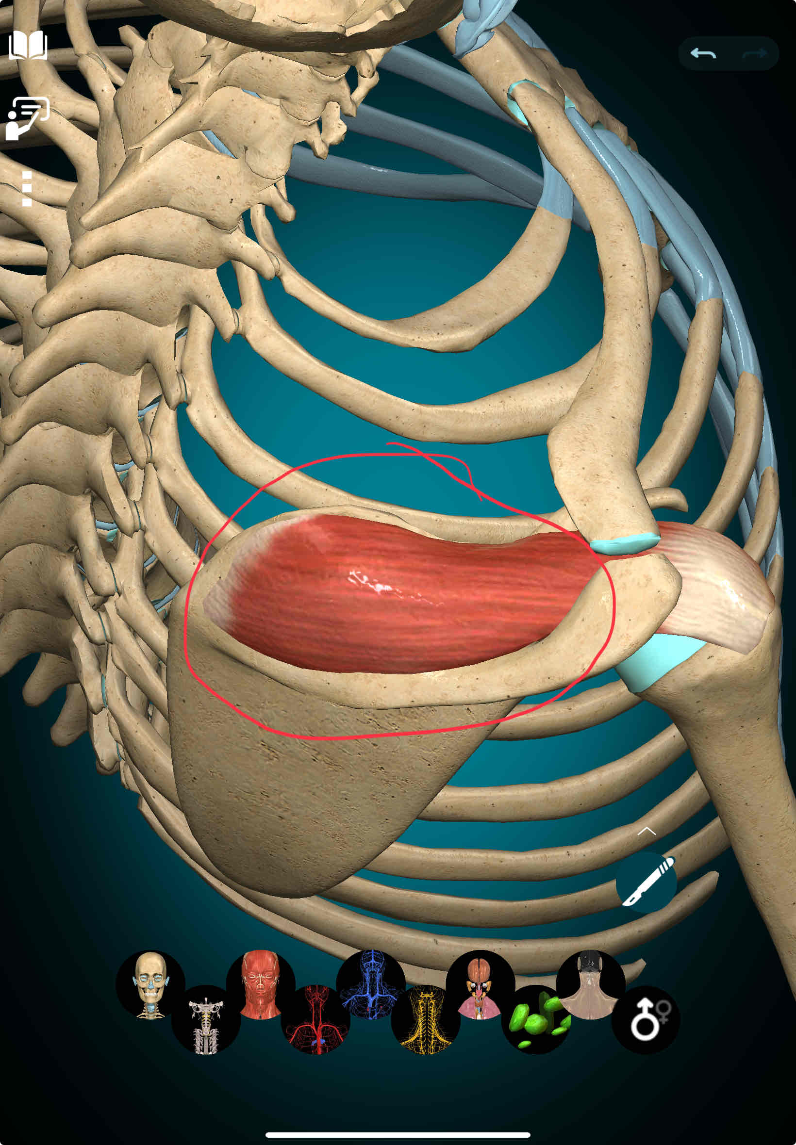 <p>Supraspinatus Origin</p>