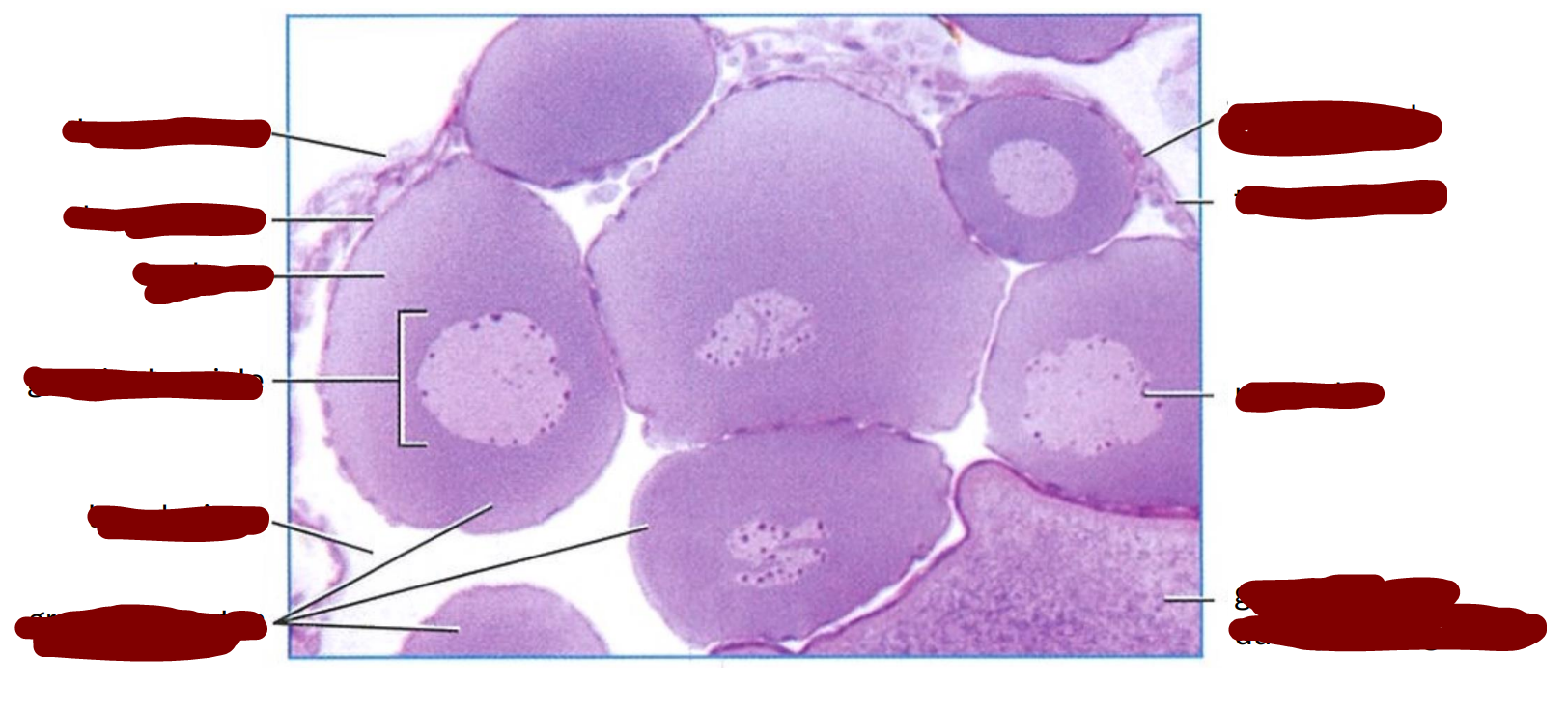 <p>Section through an area of an adult frog ovary showing growing oocytes</p>