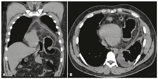 <p>CIR - diagnóstico e conduta</p>