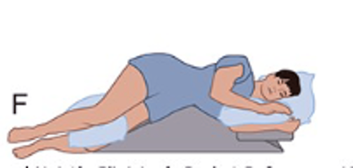 <p>-back, kident, colorrectal, hip surgery</p><p>-kidney position where a life is placed on the posterior abdmoinal wall to exaggerte retroperitoneal exposure </p>