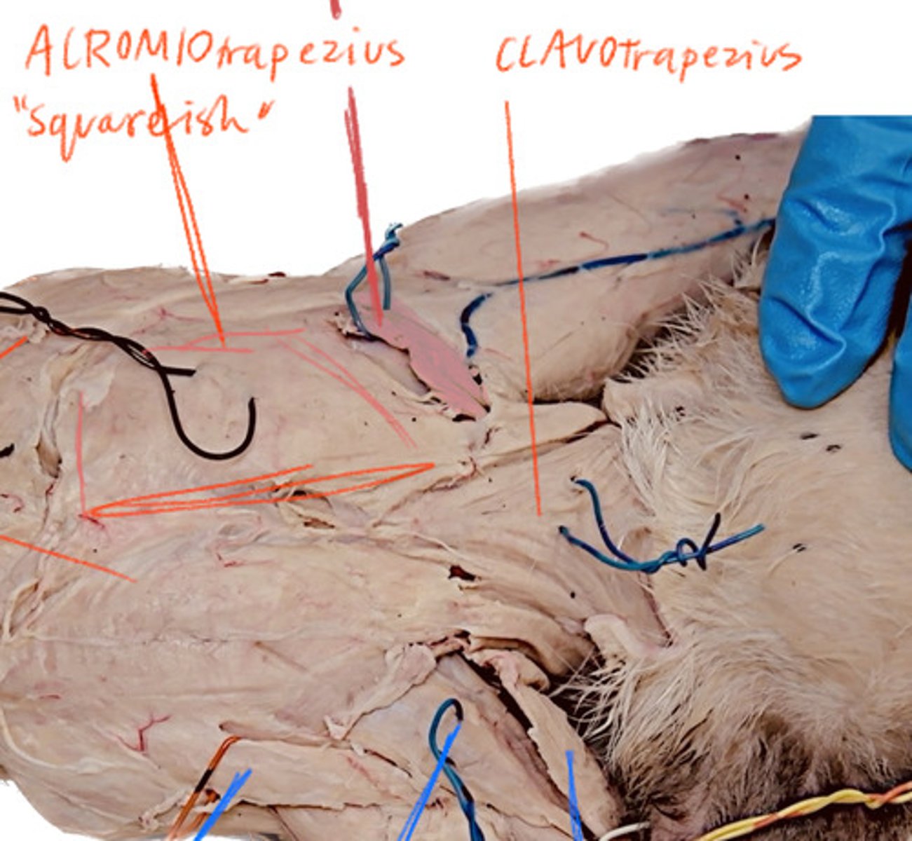 <p>Behind the Clavotrapezius</p>