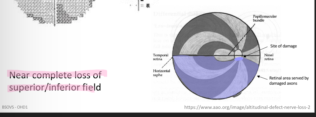 <p>Altitudinal</p>