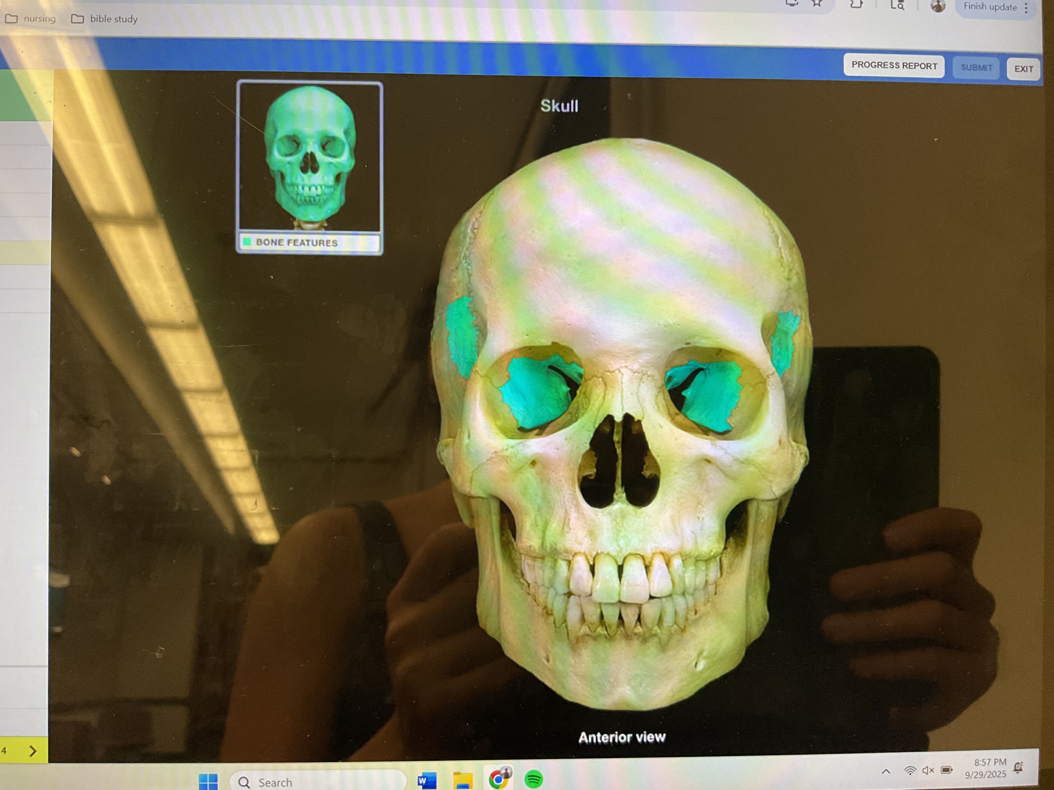 <p>Sphenoid bone </p>
