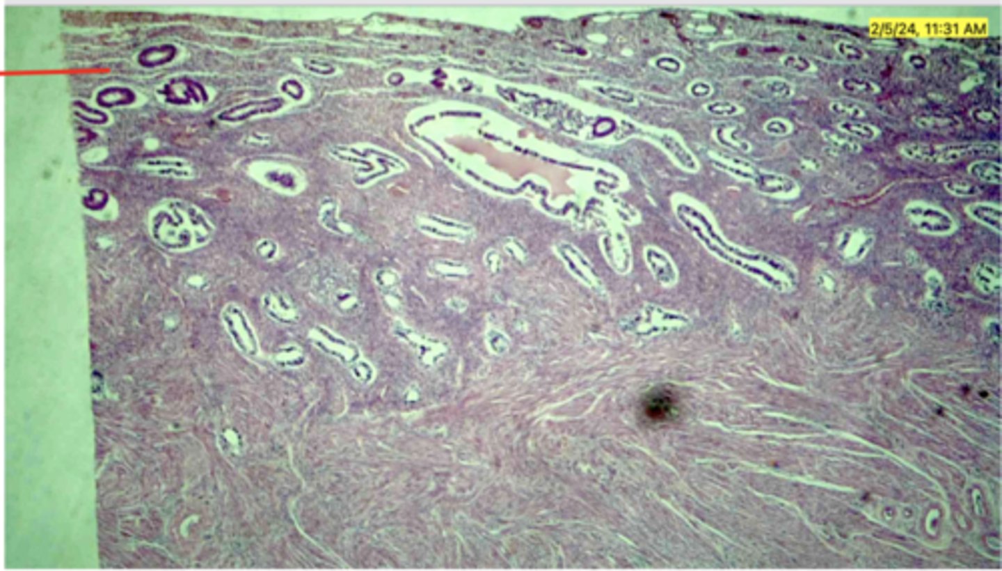 <p>Endometrial glands (simple columnar Epithelium)</p>