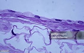 <p>What tissue is this</p>