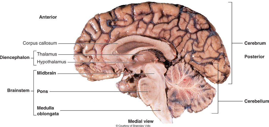 <p>Corpus Callosum</p>