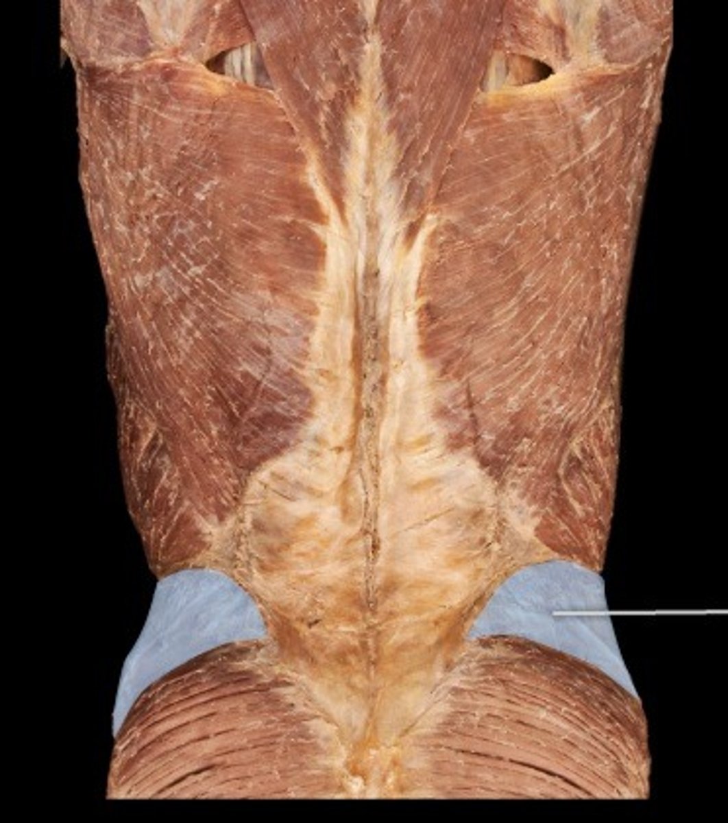 <p>What muscle is this?</p>