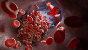 <p>Hemostasis</p>