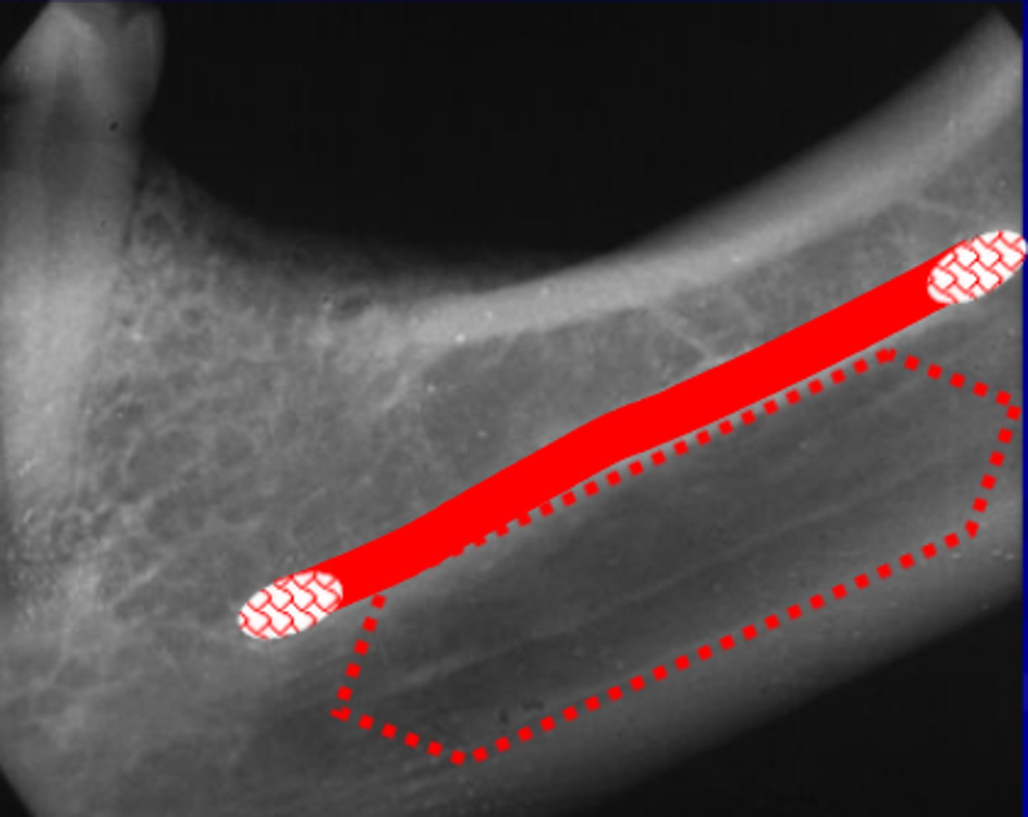 <p>Name structure that is boxed by the dotted red line.</p>