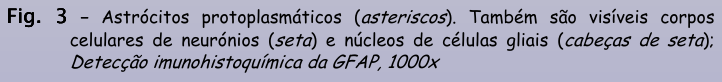 <p>astrócitos - GFAP</p>