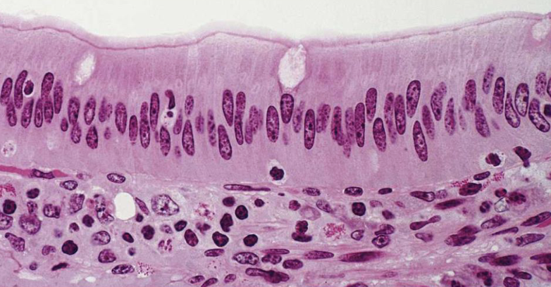 <p>what tissue is this</p>