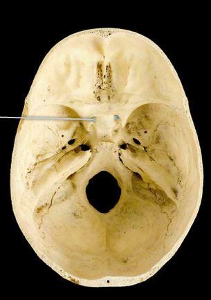 <p>optic canal</p>
