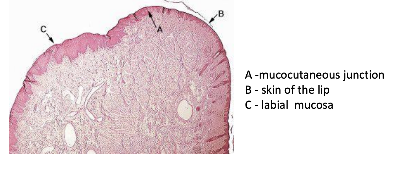 Lips and Cheeks 

External Surface of the lip has skin ( ex dermis, folliculs) with a transition: 