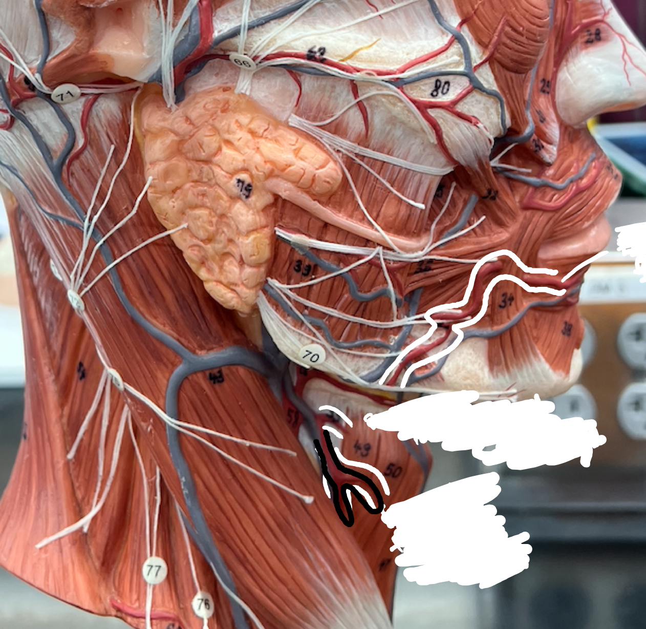 <p>The downward forking red artery, coming down along the side neck muscle</p>