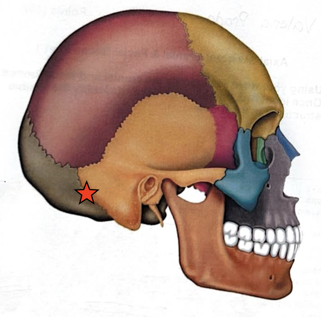 term image