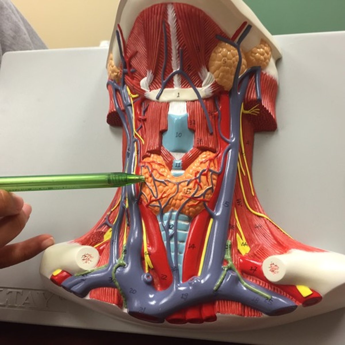 <p>What gland is this?</p>