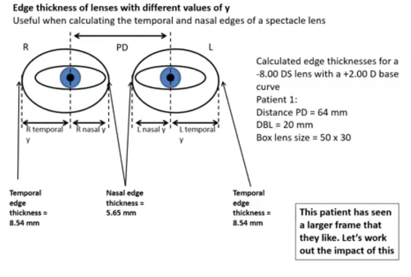 <p>whats decetration of pupil&nbsp;</p>