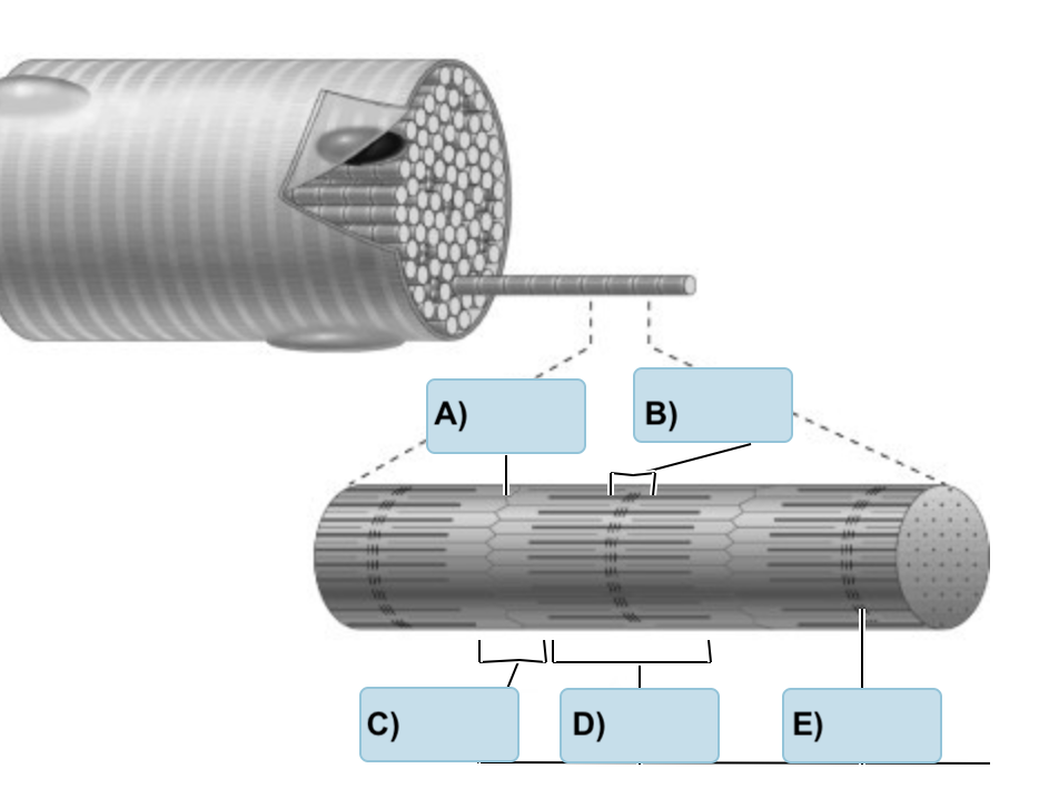 <p>Label the following</p><p></p><p>(Z Disc, M Line, A Band, H Zone, I Band </p>