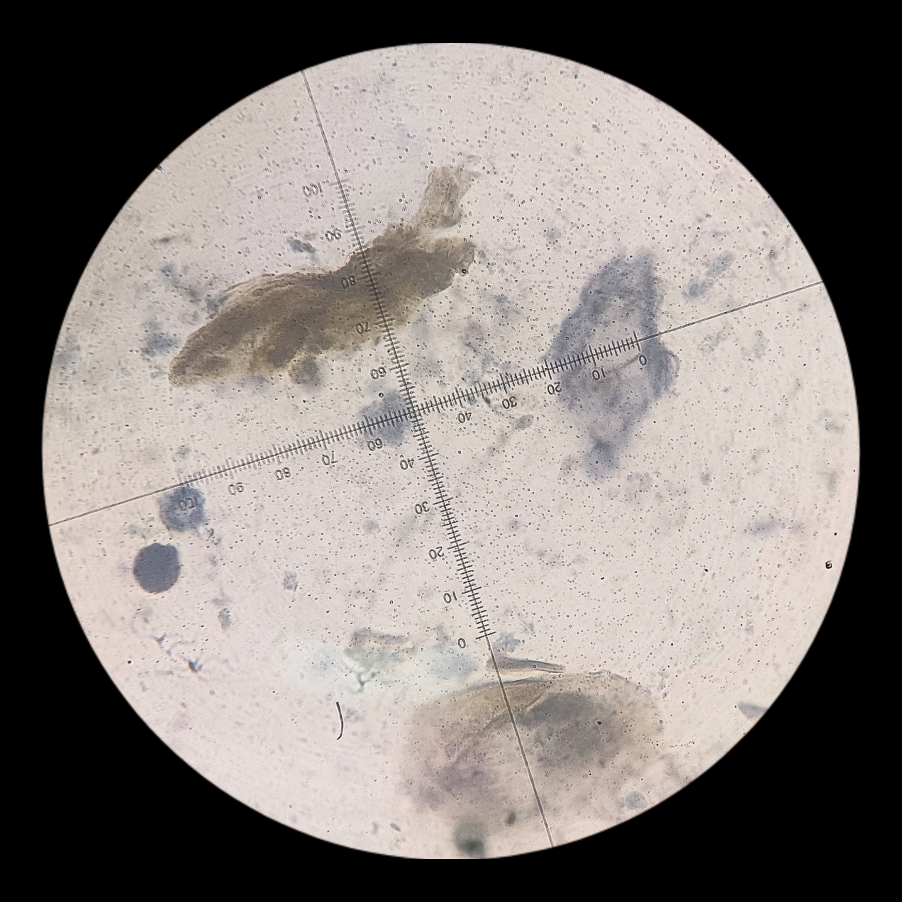 <p>General charcteristics</p><ul><li><p>Unicellular protozoan parasite.</p></li><li><p>Causes amoebiasis, which affects the intestines.</p></li><li><p>Found primarily in contaminated food and water.</p></li><li><p>Moves via pseudopodia (false feet).</p></li></ul><p></p>