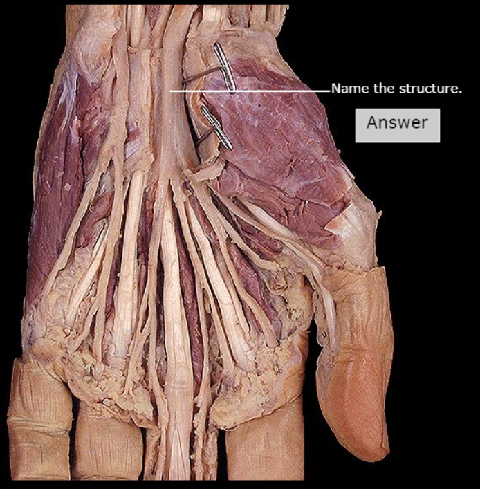 <p>What nerve is this</p>