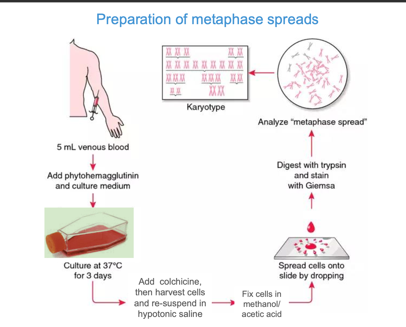 <p>metaphase - easiest to analyse for karyotyping</p><p>-We want to create a full set of chromosomes</p><p>how?</p><p></p><p>Using a blood sample - extract 5ml of venous blood (want white blood cells, specifically lymphocytes - easily cultured + have a nucleus</p><p></p><ol><li><p>extract 5ml venous blood sample</p></li><li><p>Add <strong>phytohemagglutinin </strong>(induces mitosis for clear karyotyping) and Sample is placed in a culture medium at 37 degrees celcius for 3 days</p></li><li><p>Add colchicine + harvest the cells and re-suspend in hypotonic saline - water enters the cells by osmosis - cells swell and are easy to visualise for chromosome analysis</p></li><li><p>fix cells in methano / acetic acid - preserves the chromosomes</p></li><li><p>digest with trypsin and stain with GIEMSA</p><p><strong>-trypsin </strong>digests proteins on the chromosome surface such a histones - make the DNA easier to stain</p><p>Giemsa - binds to dna - creates a <strong>distinct pattern of light and dark bands </strong>along the chromosomes</p><p><strong>Trypsin - controlled digestion</strong></p></li></ol><p></p><p>Identifying chromosomes</p><p><strong>-identified by SIZE + BANDING PATTERN</strong></p><p><strong>Positively staining bands are known as G-BANDS (</strong>think g for <strong>Giemsa)</strong></p><p></p>