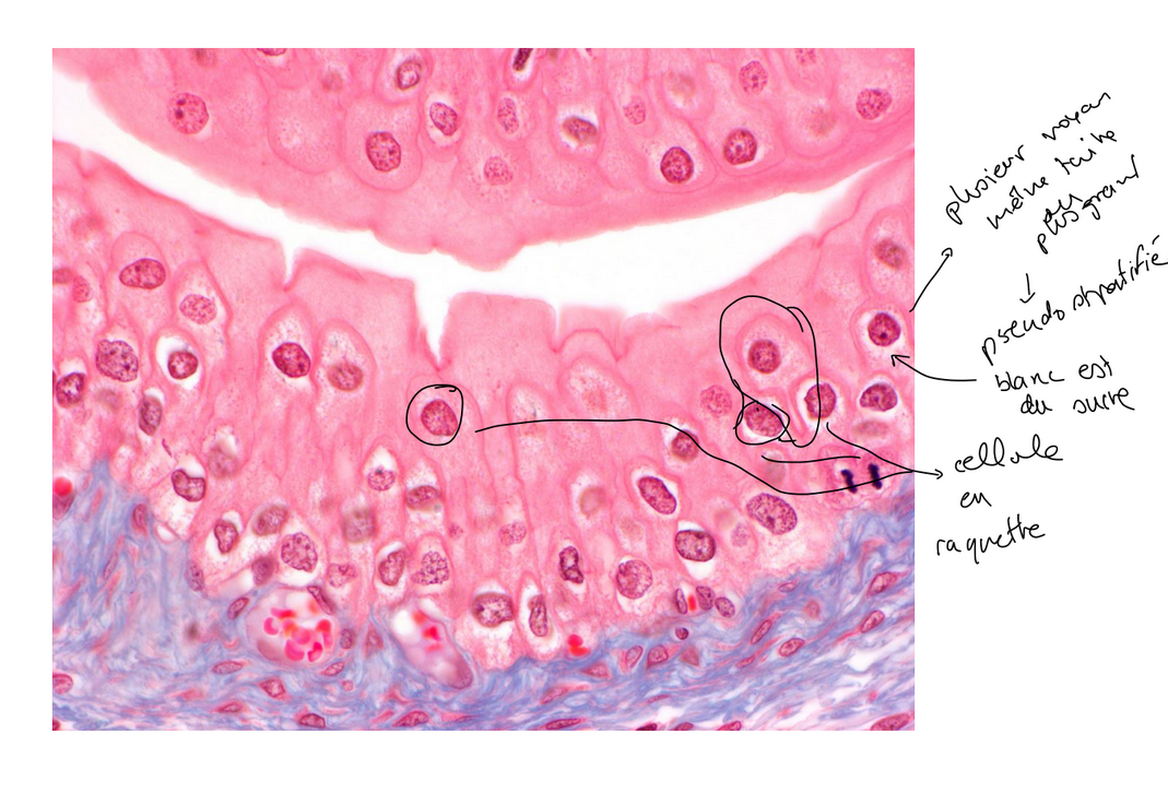 <p>epithelium pseudostratifie</p>