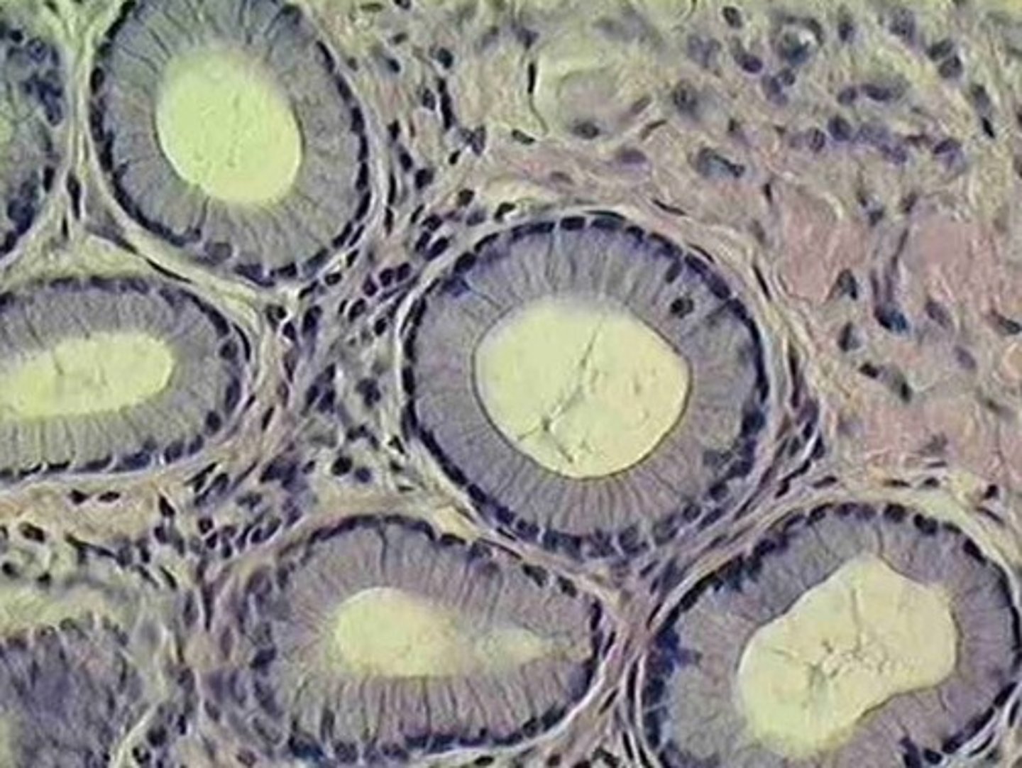<p>glands of the stomach</p>