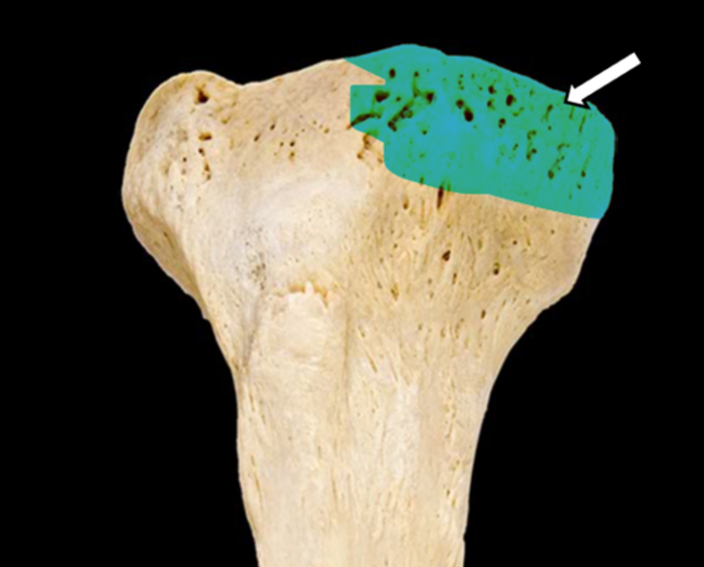 <p>name the part</p>