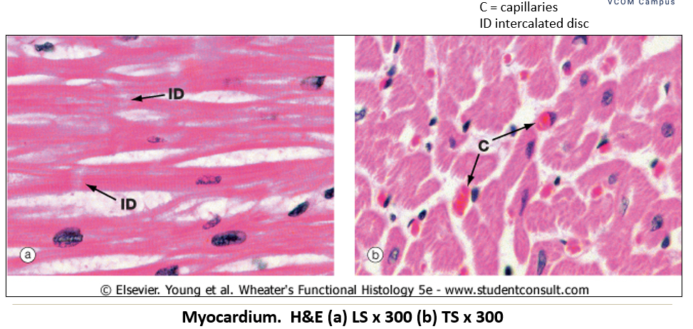 <p>Appearance of <strong>myocardium </strong>on histological slide?</p>