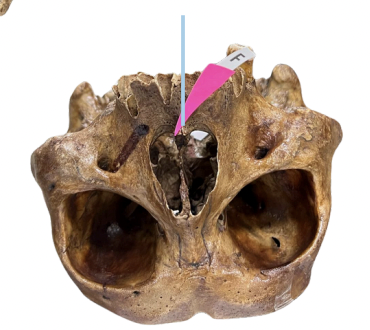 <p>Identify the structure of the skull labelled as F.</p>