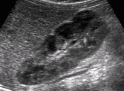 <p>Is this a normal adult kidney?</p>