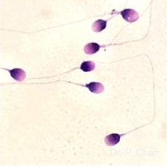<p>Identify the sperm morphology.</p>