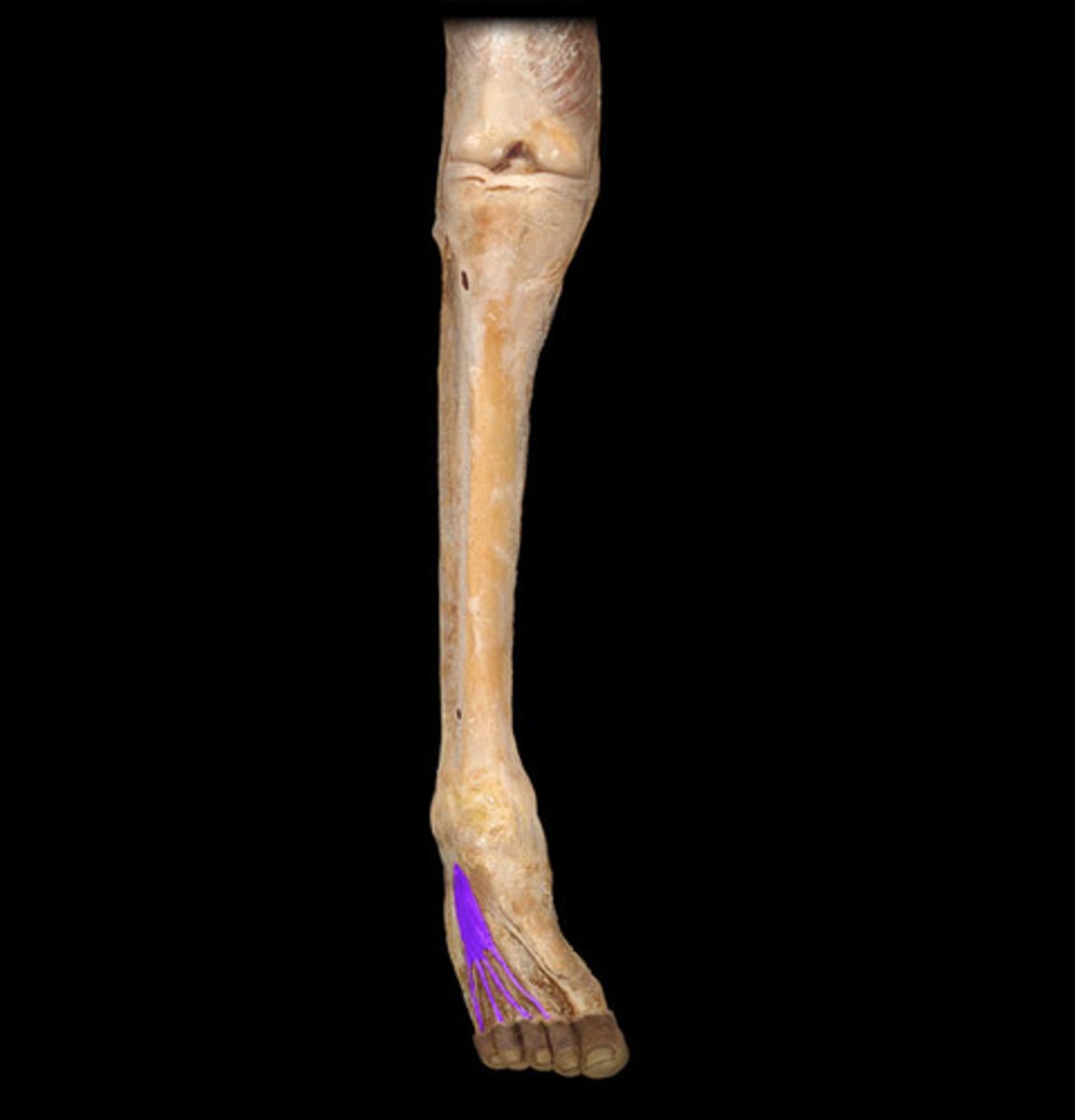 knowt flashcard image