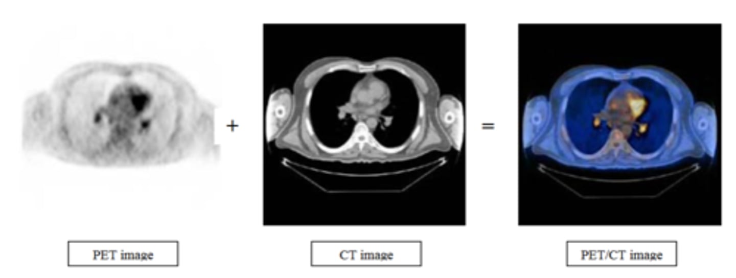 <p>Combines CT's anatomic detail and PET's physiologic detail for high quality images</p>