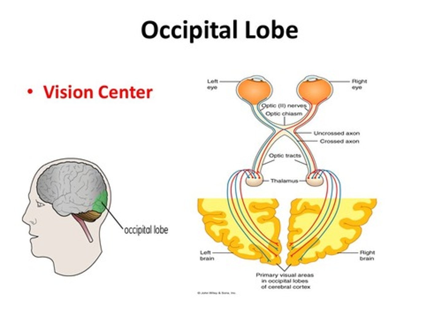 <p>Radio Frequency Lesions don't just destroy neurons in that specific brain area, but they also destroy any neurons that are passing through. Perhaps, some of the neurons passing through the damaged area are heading to or from the Occipital Lobe.</p>