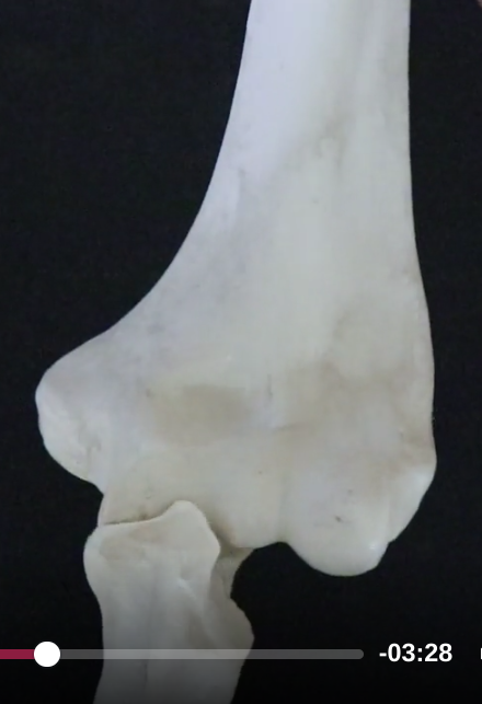 <p>Humerus - trochlea (a condyle)</p>