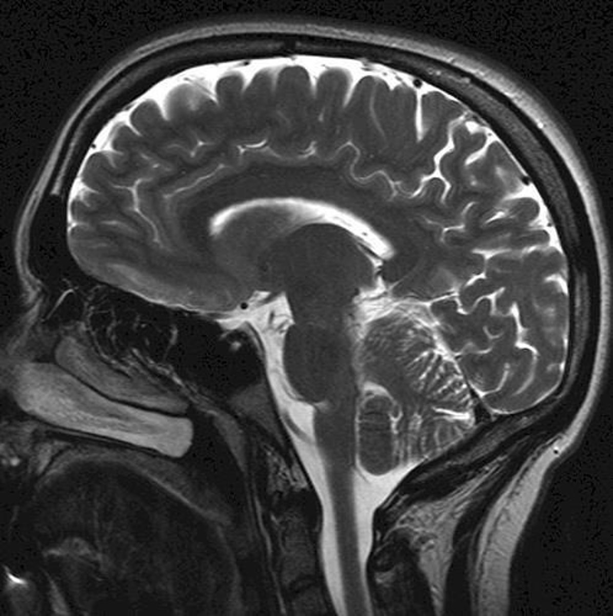 <p>Frontal, Parietal, Temporal, Occipital.</p>