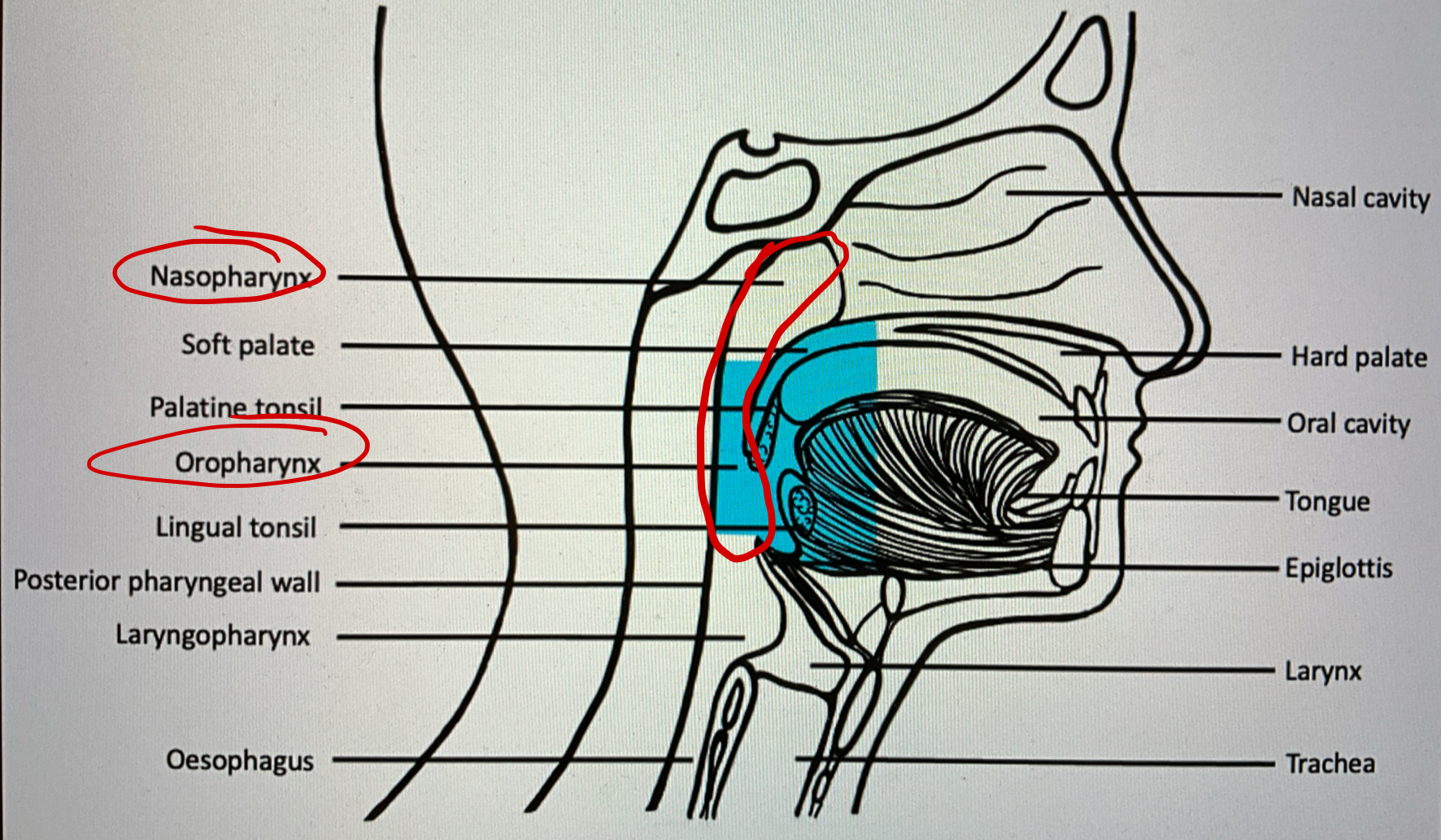 <p>the area directly posterior to the mouth and nose. It is made up of the oropharynx and the nasopharynx</p>