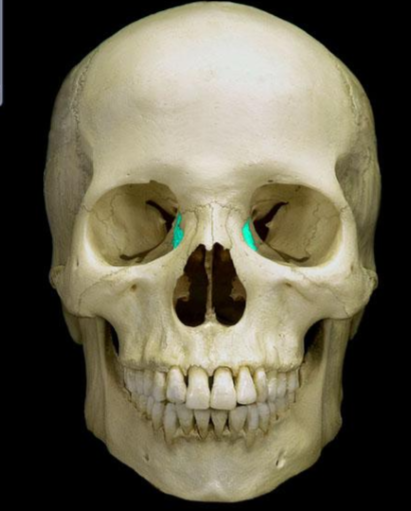 <p>What bone is this?</p>