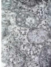 <p>(dark granules)</p>